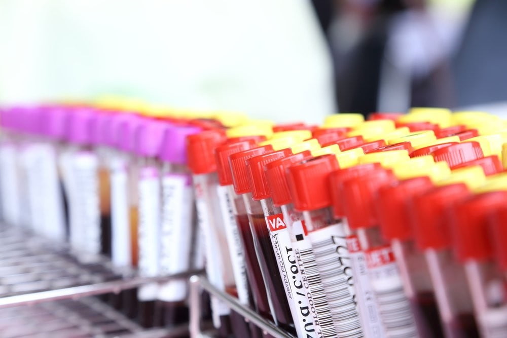 Entendendo exame de sangue Entendendo exame de sangue